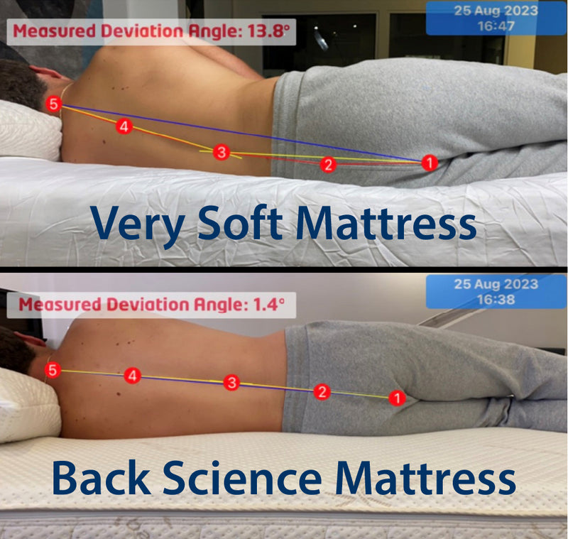 Spinal alignment comparison of dipping and sagging on a soft mattress vs proper spinal alignment on a back science mattress